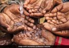 पानी से घिरा, फिर भी पानी को तरसता शहर – कब जागेंगे जिम्मेदार?